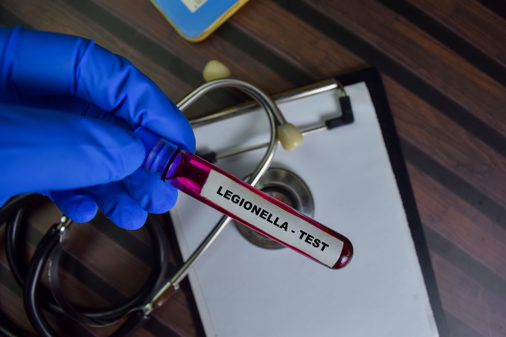 Protect your employees and customers from Legionnaires' disease outbreaks with our online UK Legionnaires' disease awareness course. Our training covers Legionella bacteria, risk factors, prevention measures, and legal requirements, ensuring your business is compliant with regulations. With convenient online access, you can learn at your own pace and become certified in Legionnaires' disease awareness. Enrol now and safeguard your business against this potentially fatal illness.